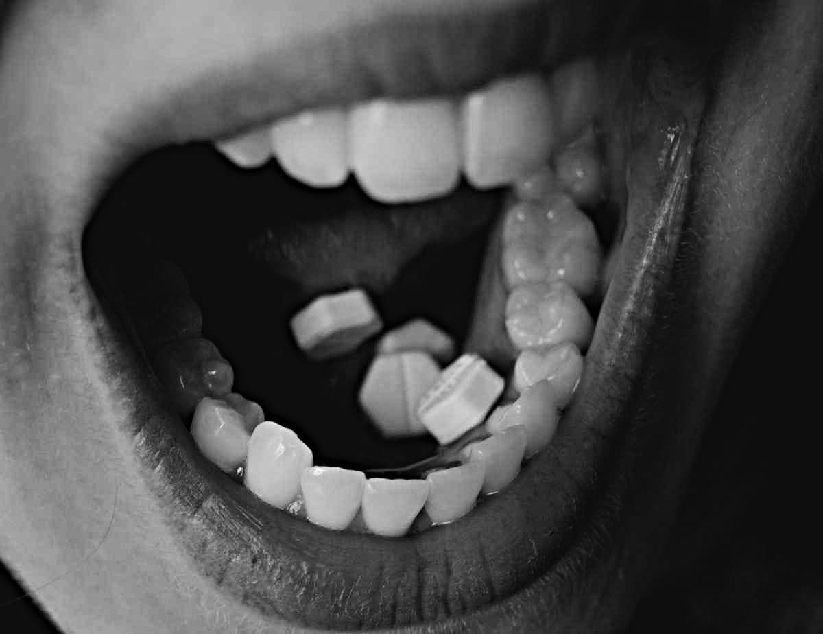 Picture showing where to put Cytotec under the tongue